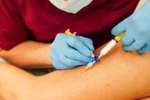 Escleroterapia